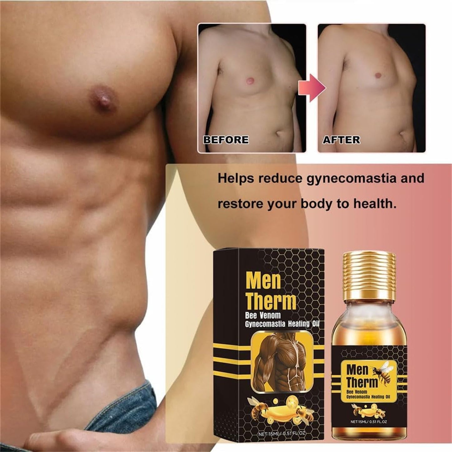 Men Therm Bee Venom - Mentherm Bee Venom Gynecomastia Heating Oil, Mentherm Bee Venom Gel,Gynecomastia Tightening Oil for Men,Men Therm Bee Venom Oil for Strengthen The Chest Muscles (1 Pcs)